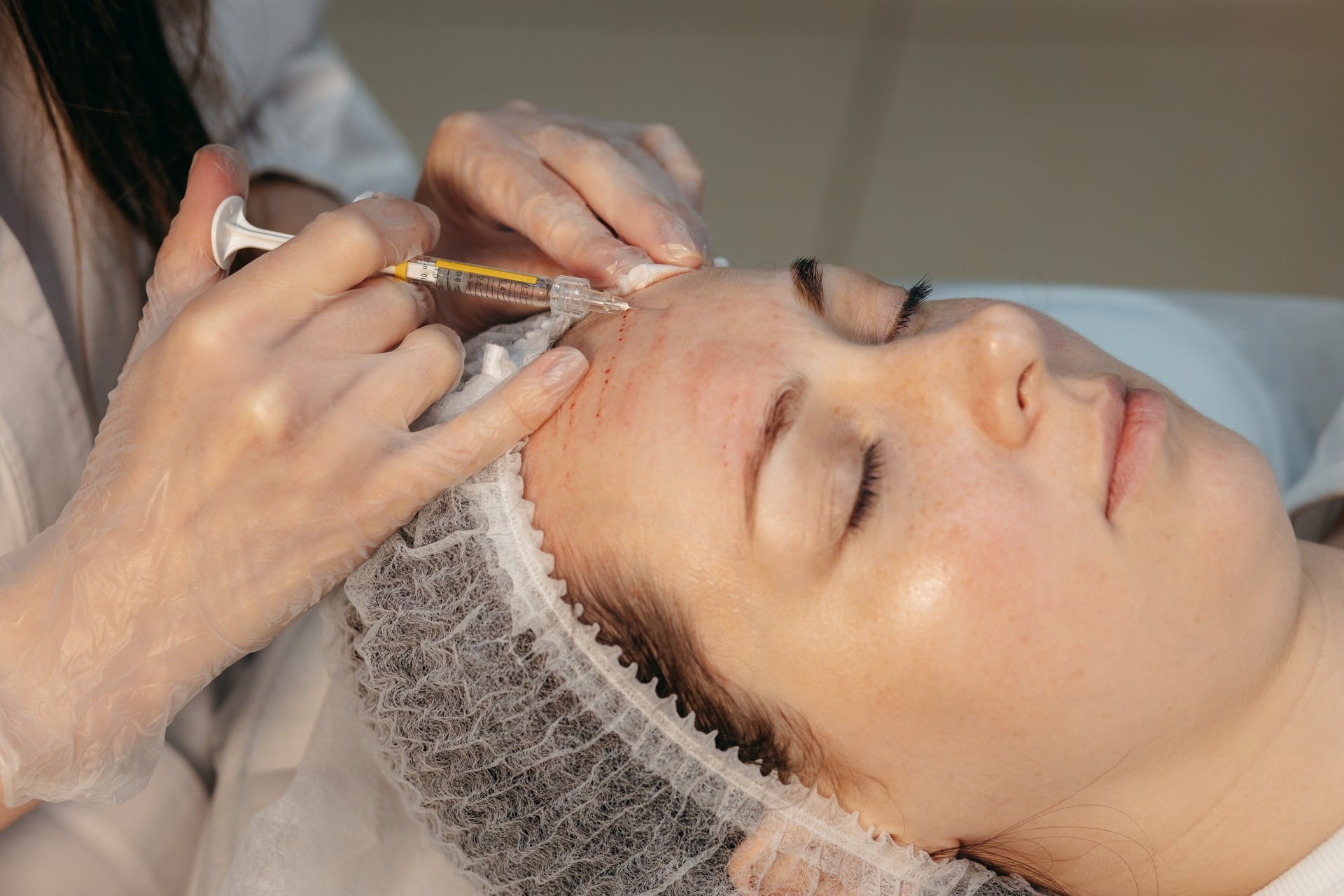 Plazma pen: tretman za zatezanje i pomlađivanje kože bez operacije